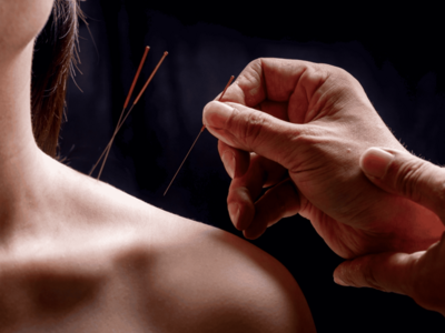 Beneficios de la acupuntura a sobrevivientes de cáncer de mama