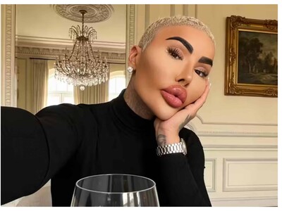 "El rey de los labios", el influencer que murió por su obsesión